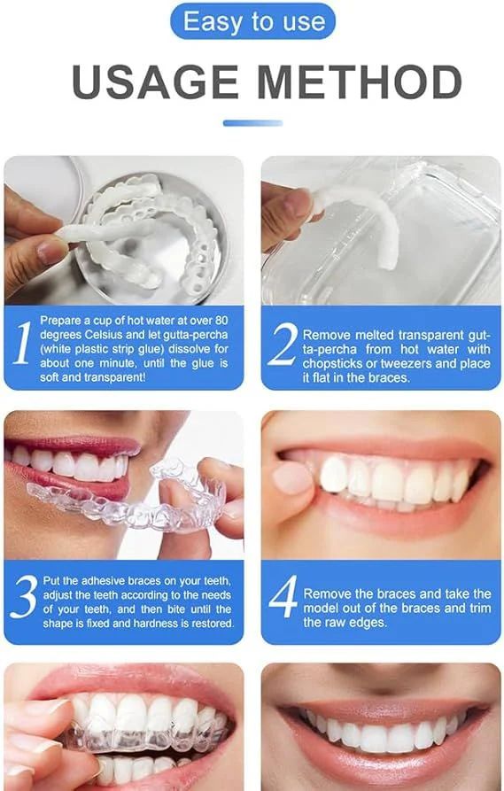 Snap On Smile Veneers Teeth For Men And Women