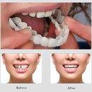 Snap On Smile Veneers Teeth For Men And Women